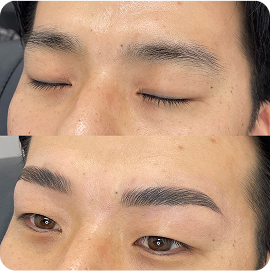 home treatment sample